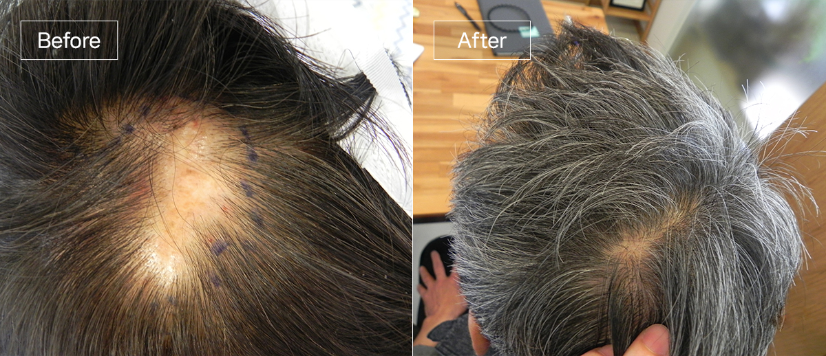 /filedata/md_board/20260102172943_Zh5FlxGj_sub6_slide1.jpg 전후사진