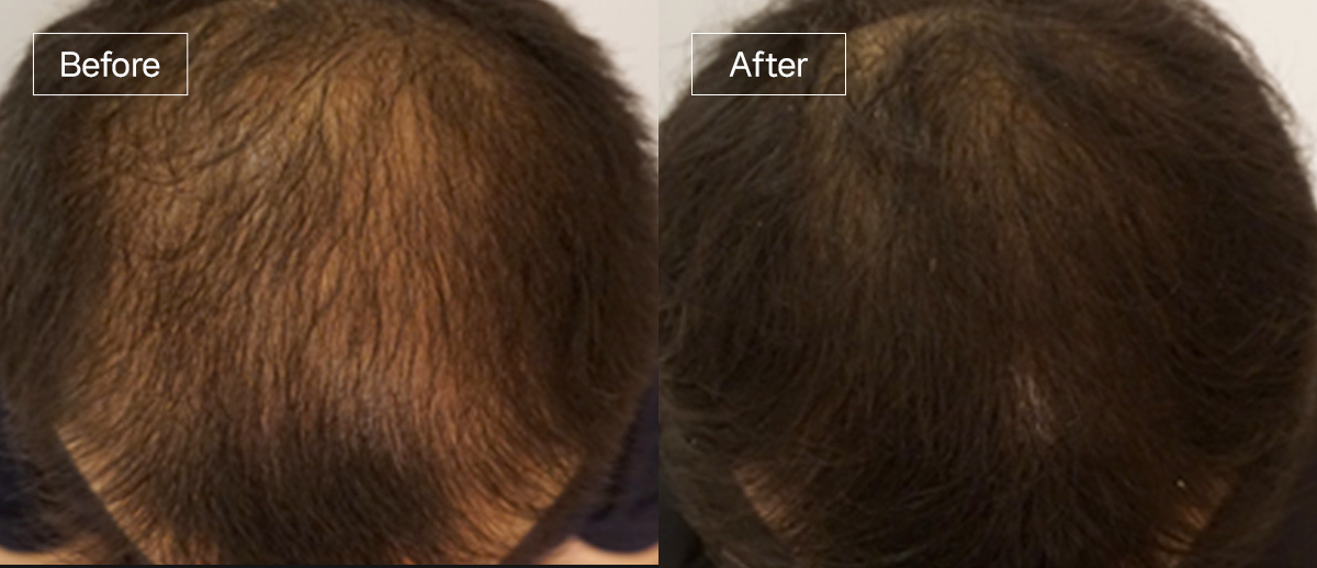 /filedata/md_board/20260102173023_u5ro7kBf_sub4_slide10.jpg 전후사진