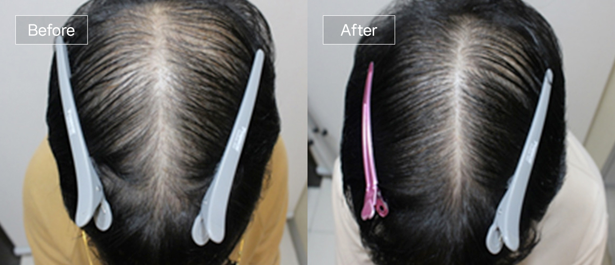 /filedata/md_board/20260102173031_Ft3vKnDg_sub4_slide9.jpg 전후사진