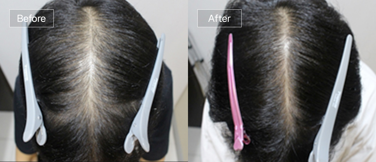 /filedata/md_board/20260102173039_oW1v5zLT_sub4_slide8.jpg 전후사진