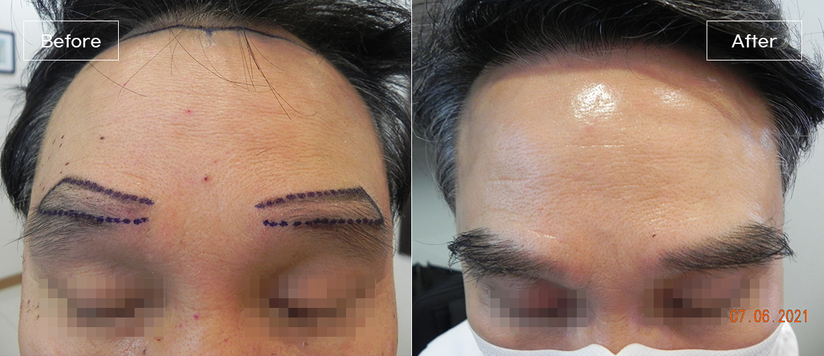 /filedata/md_board/20260205014911_IS1jKCN5_1.jpg 전후사진