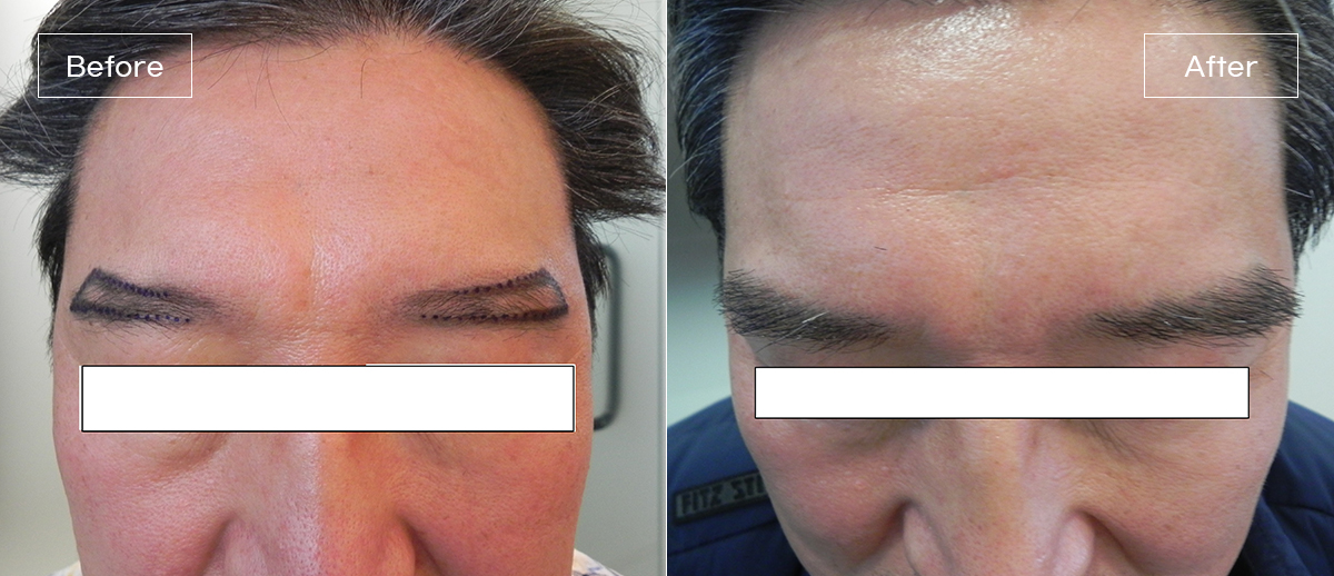 /filedata/md_board/20260205014920_aCExFbfv_2.jpg 전후사진