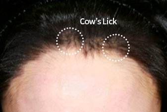cow’s lick