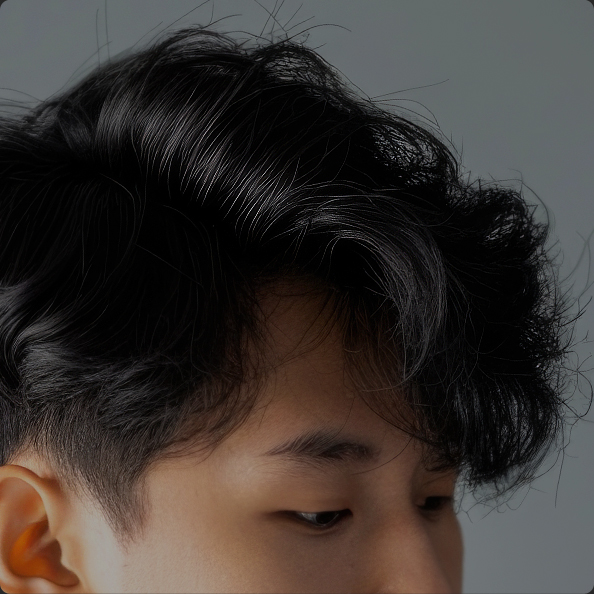 연세모벨르의원 헤어라인교정